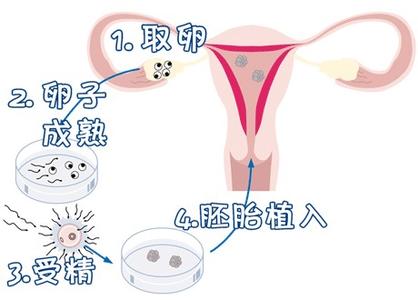 光愈生殖医学中心环境